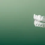 Invisalign in Pineville, NC: A Modern Solution for a Straighter Smile